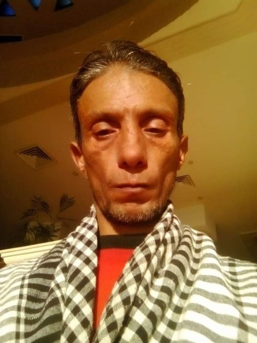 ماذا بعد أوكرانيا؟