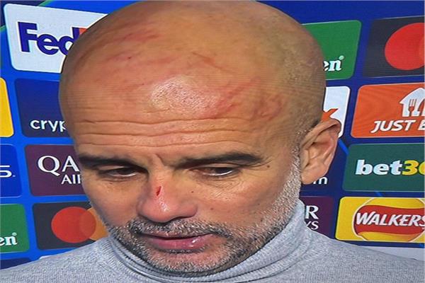 جوارديولا يجرح وجهه بعد سقوط السيتي المتتالي