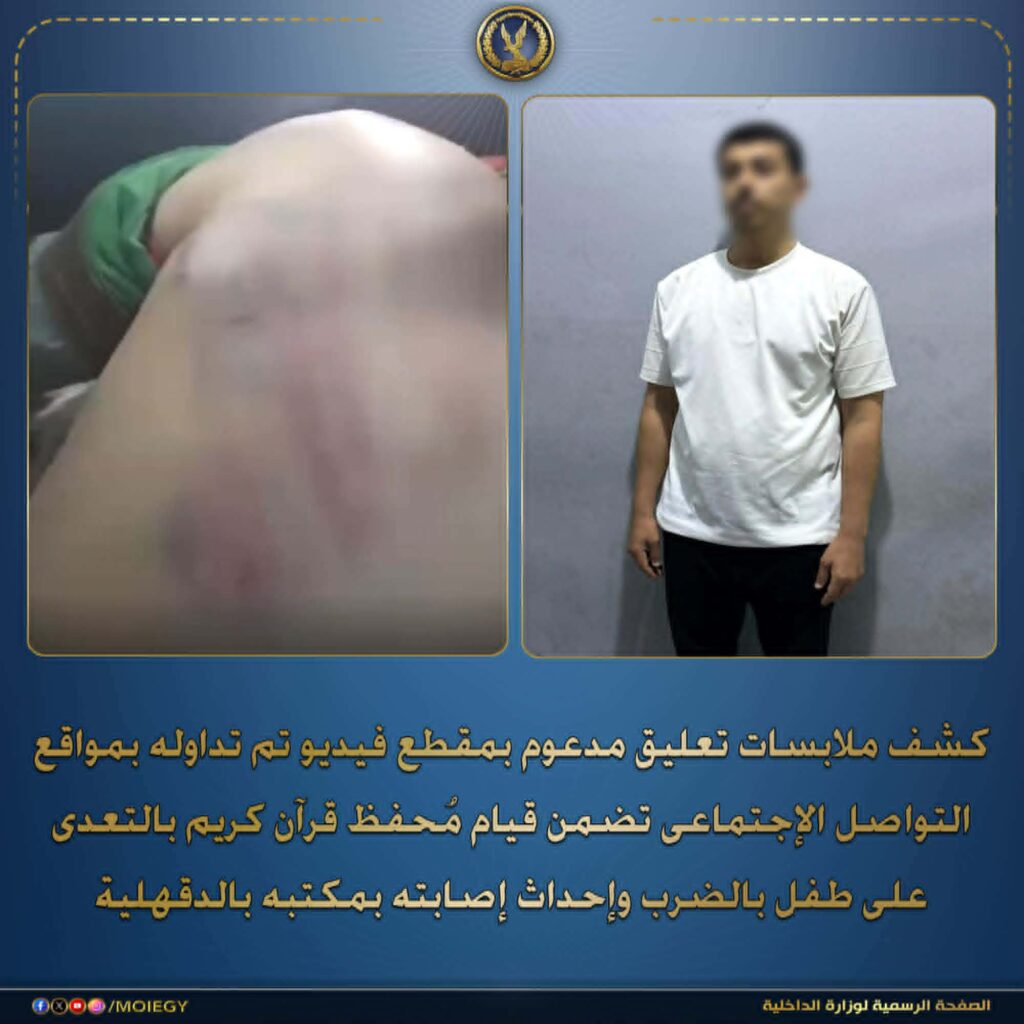الأمن يضبط محفظ قرآن بالدقهلية تعدى بالضرب على طفل وأحدث إصابته